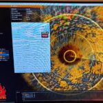 868a2b6fc3dcc0ff742381f9983f1468